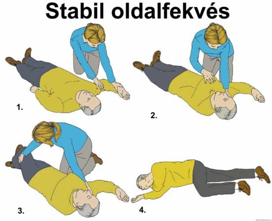 Stabil oldalfekvés